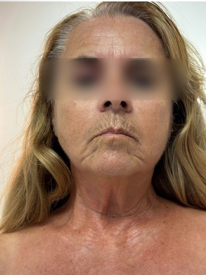 The same client after treatment