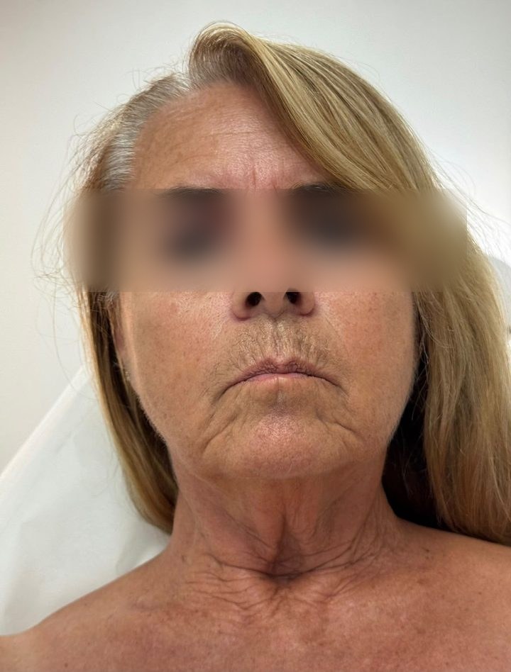 Client before treatment